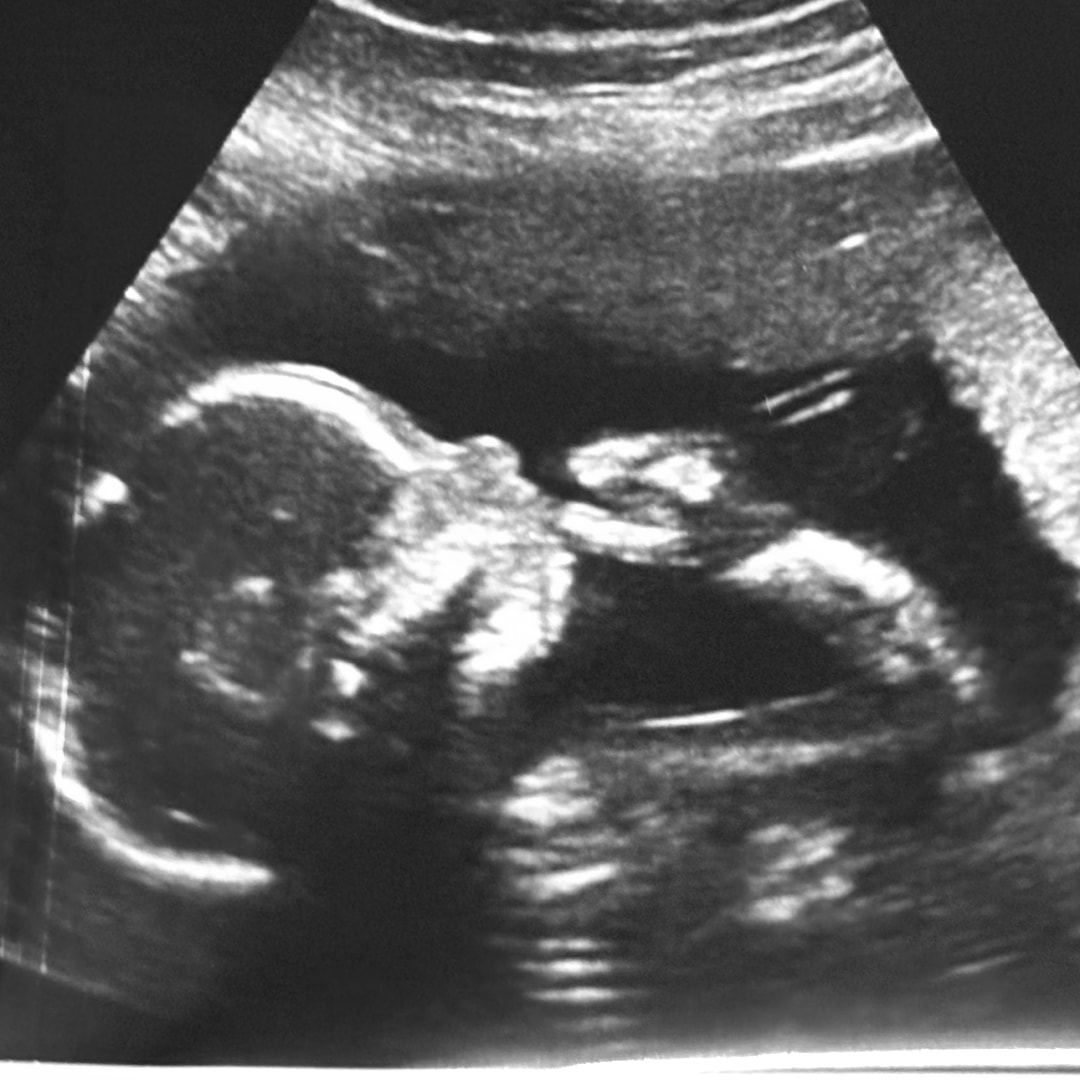 Photo shared by Lacie for their Babylist baby registry.