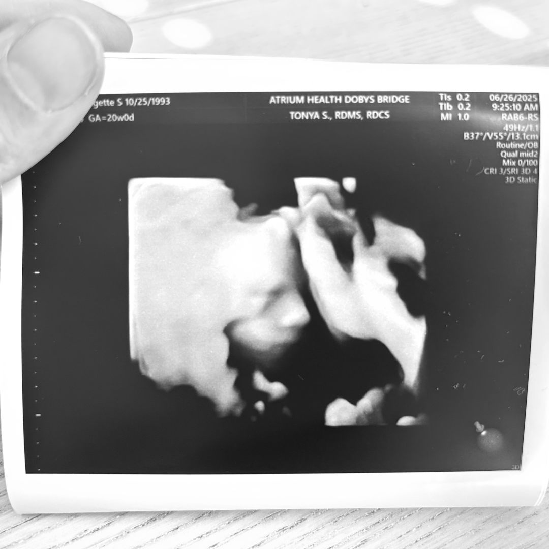 Photo shared by Bridgette for their Babylist baby registry.