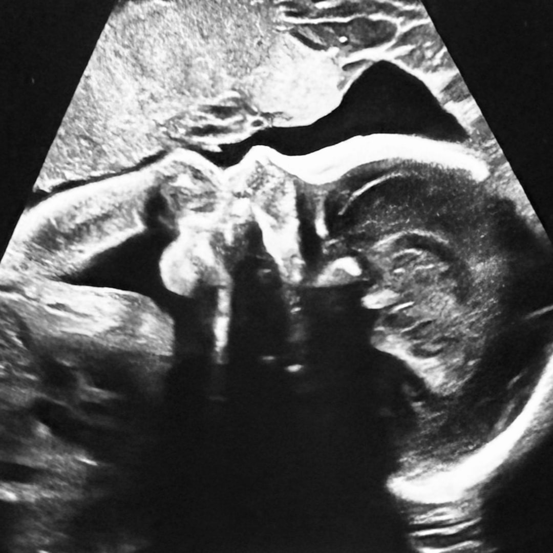 Photo shared by Allie for their Babylist baby registry.