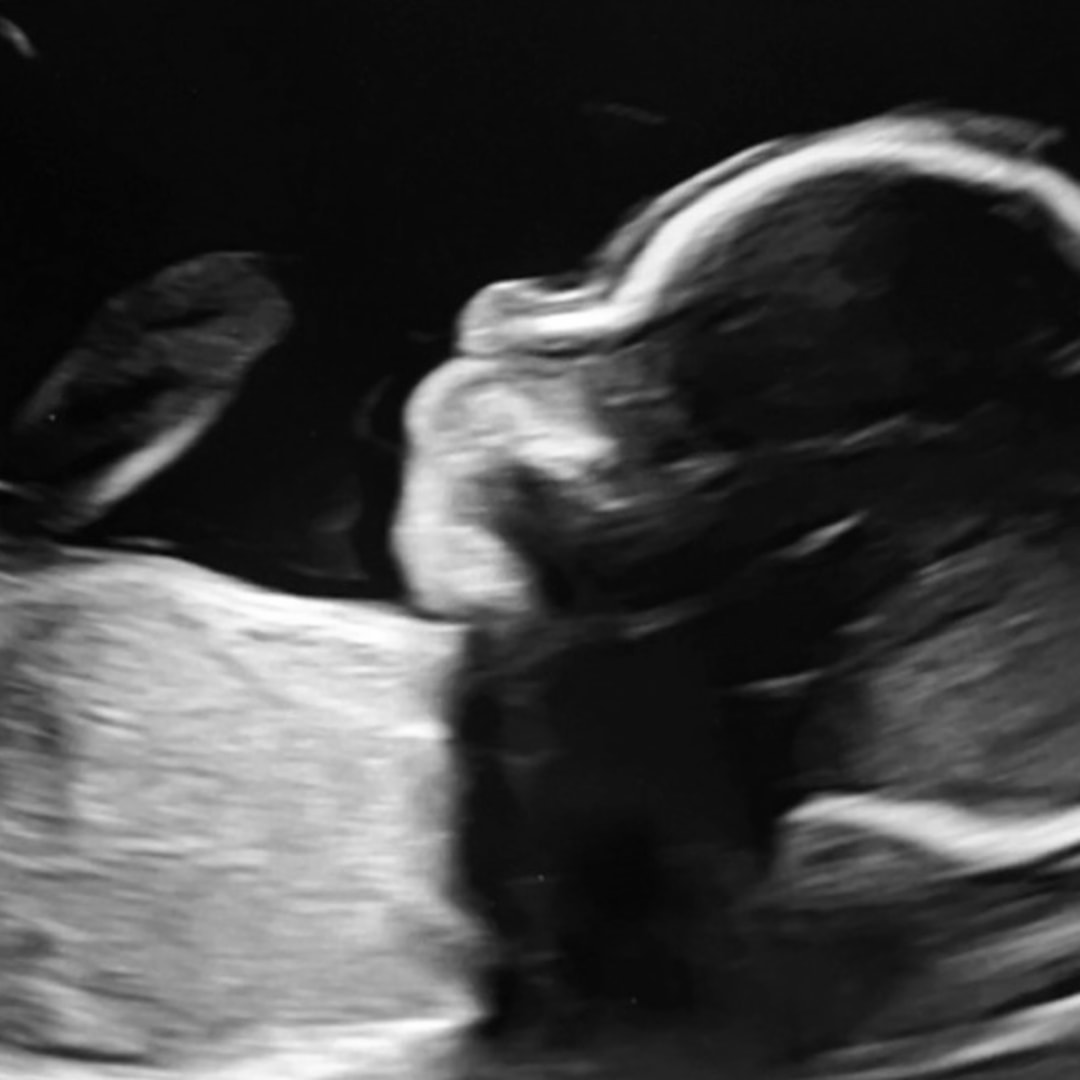 Photo shared by Anna Marie for their Babylist baby registry.