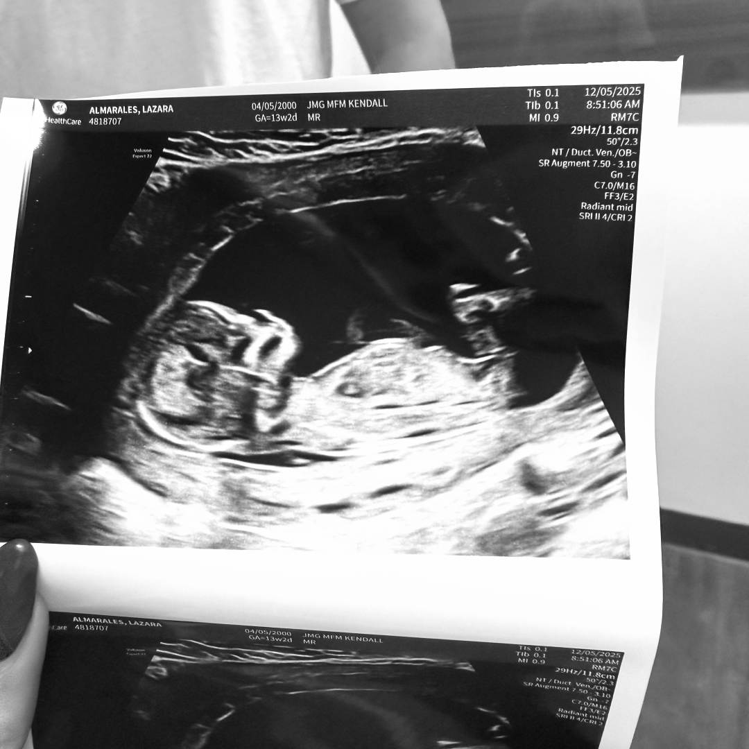 Photo shared by Lucy for their Babylist baby registry.