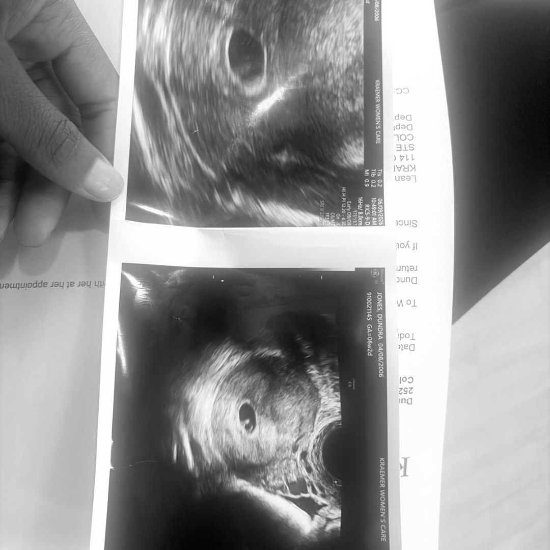 Photo shared by Dundra for their Babylist baby registry.