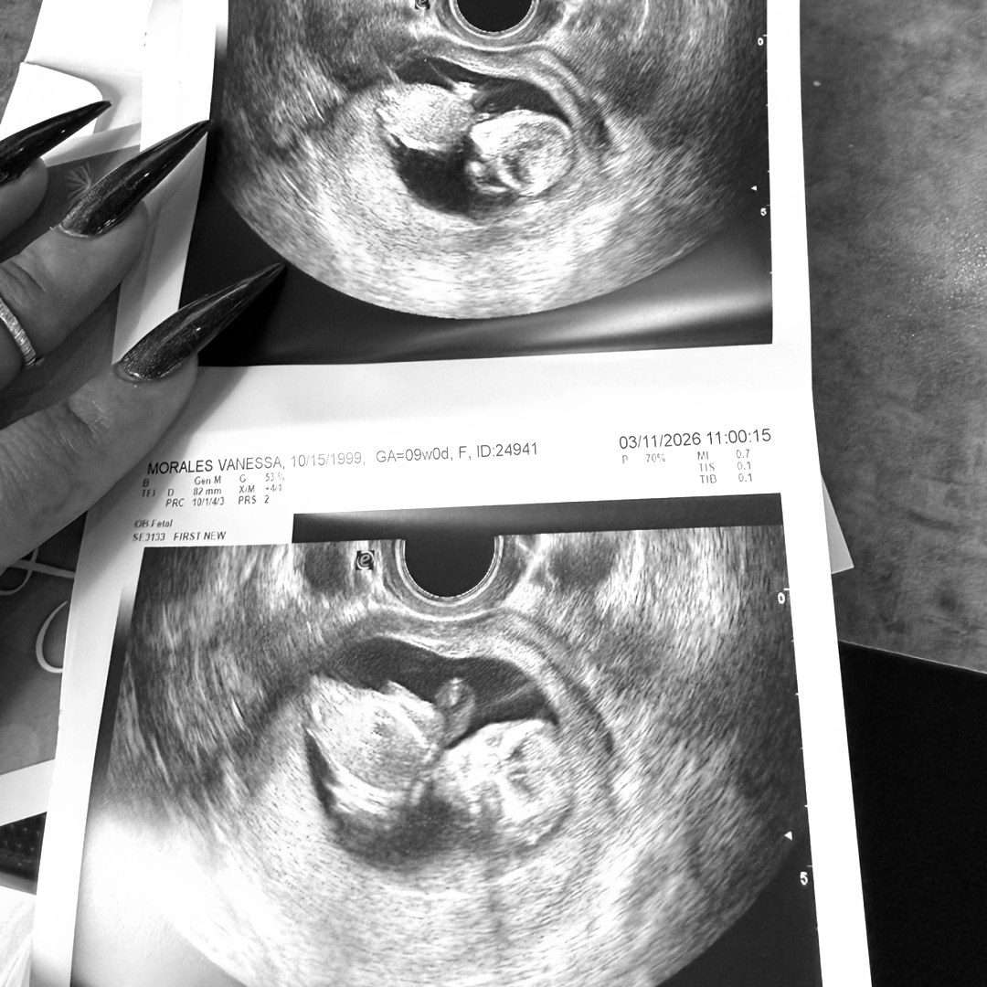 Photo shared by Vanessa for their Babylist baby registry.