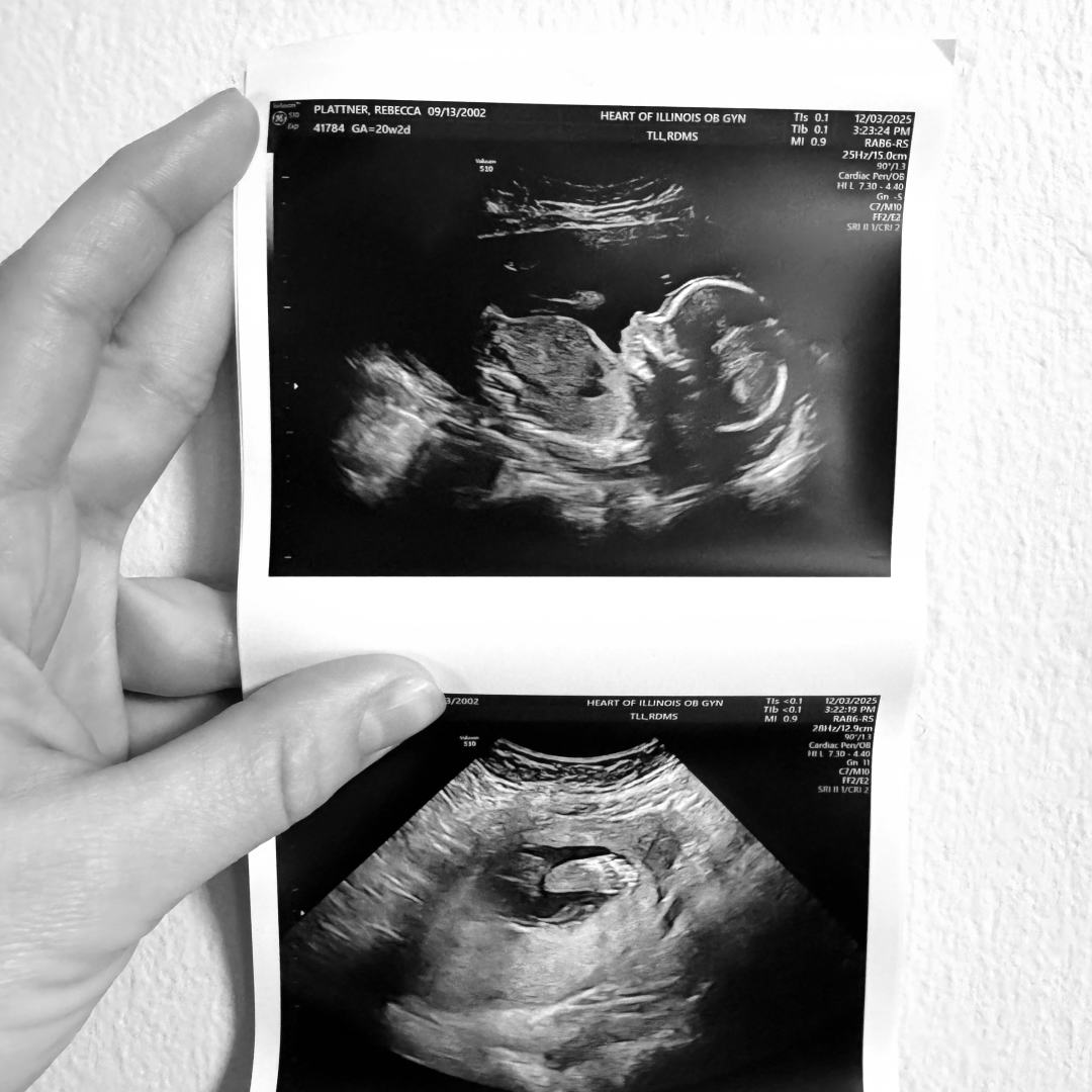 Photo shared by Rebecca for their Babylist baby registry.