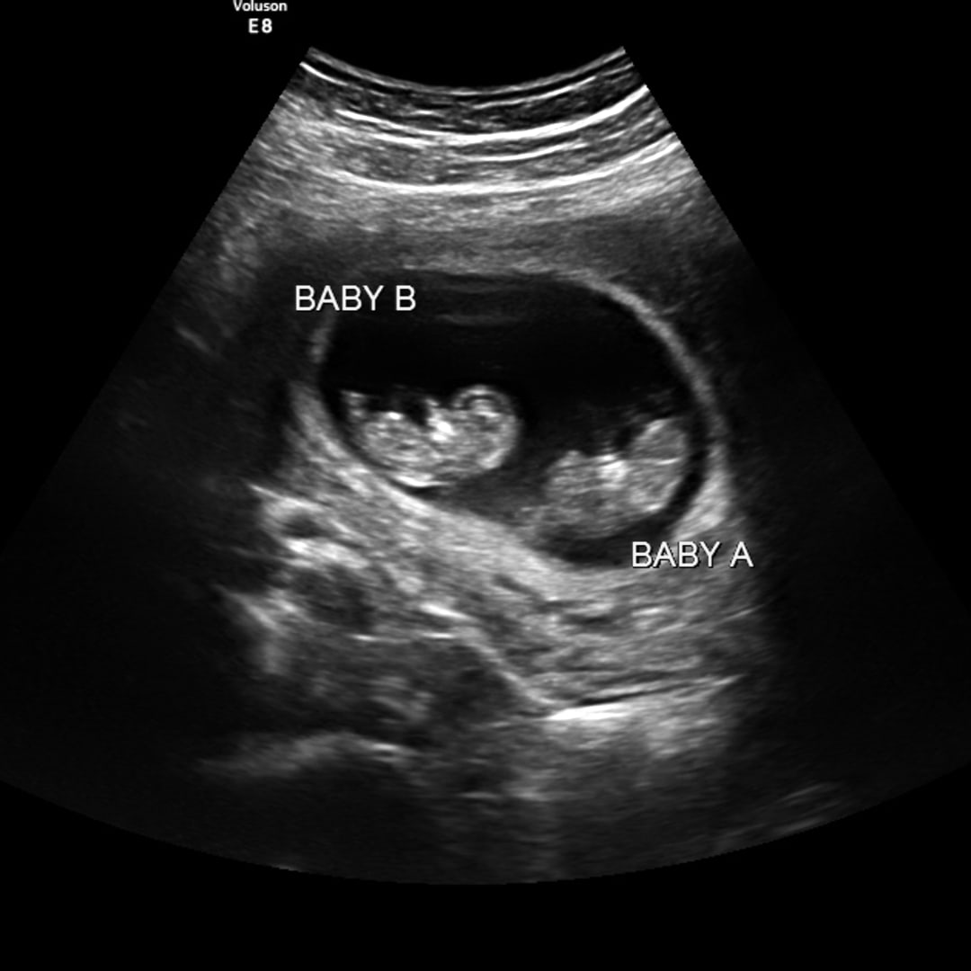 Photo shared by Caroline for their Babylist baby registry.