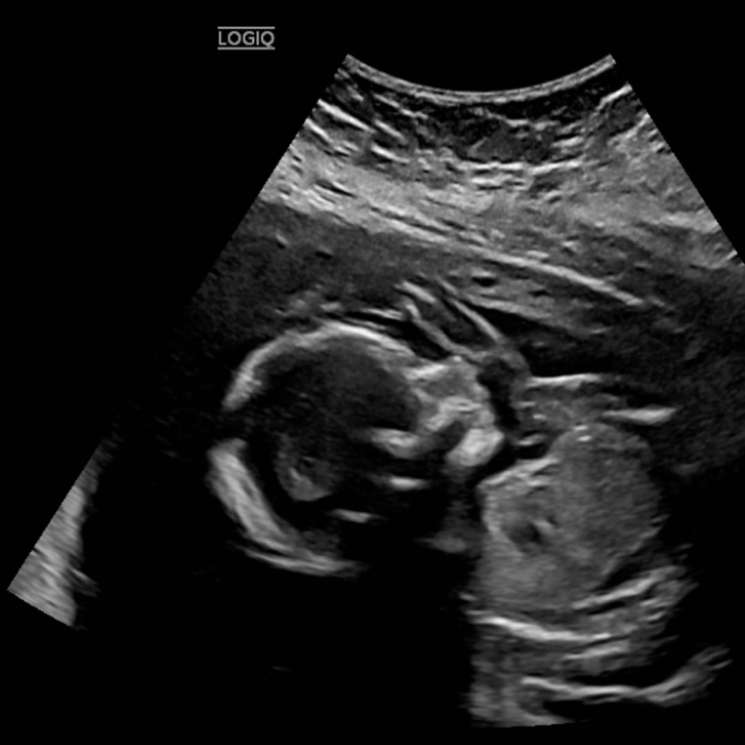 Photo shared by Alexis for their Babylist baby registry.