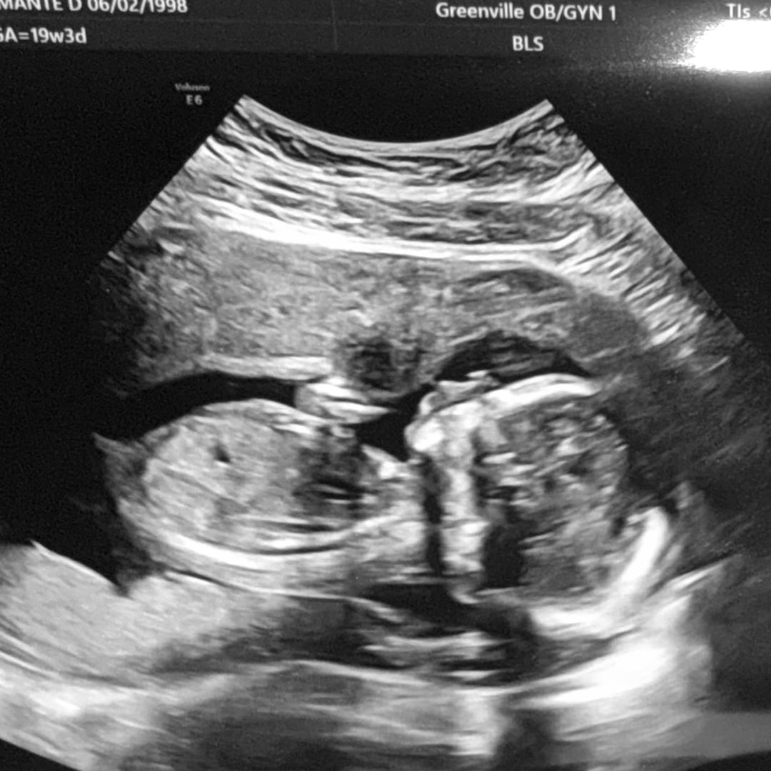 Photo shared by Diamante' for their Babylist baby registry.