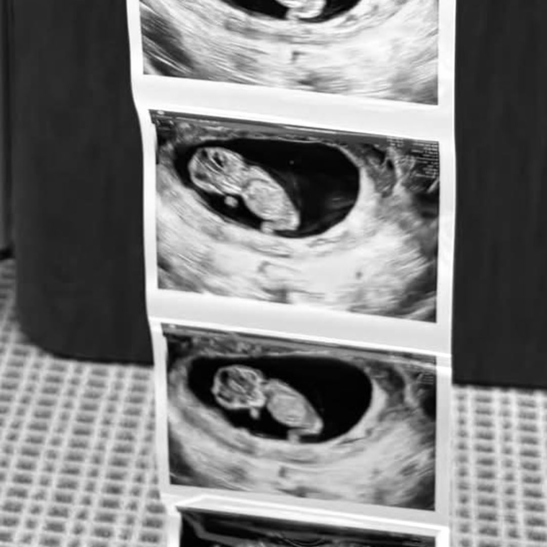 Photo shared by Alicia for their Babylist baby registry.