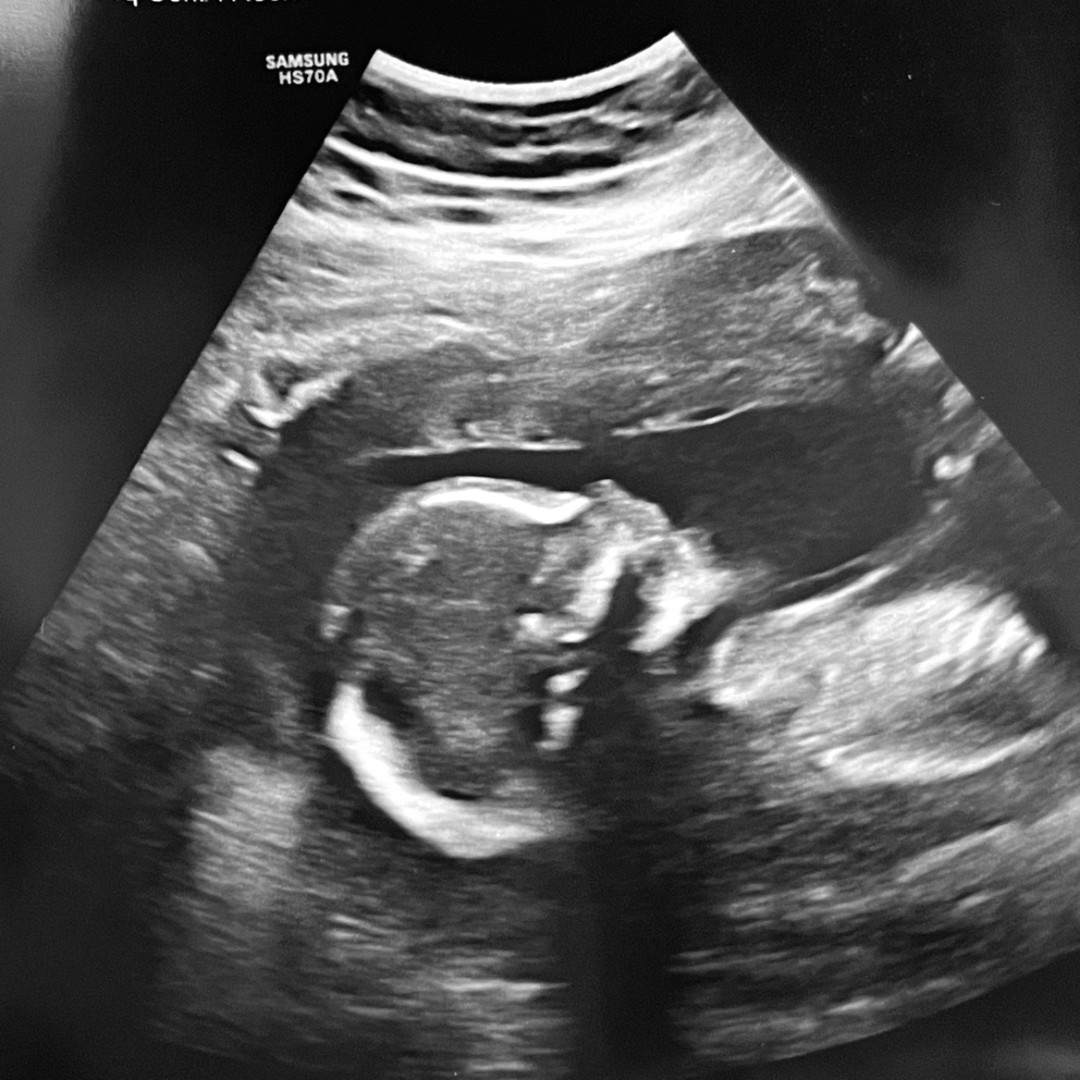 Photo shared by Madison for their Babylist baby registry.