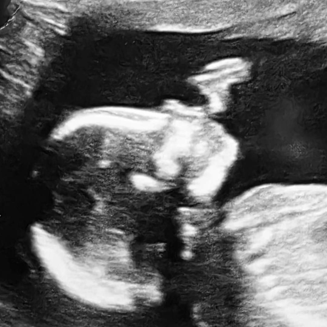 Photo shared by Sara for their Babylist baby registry.