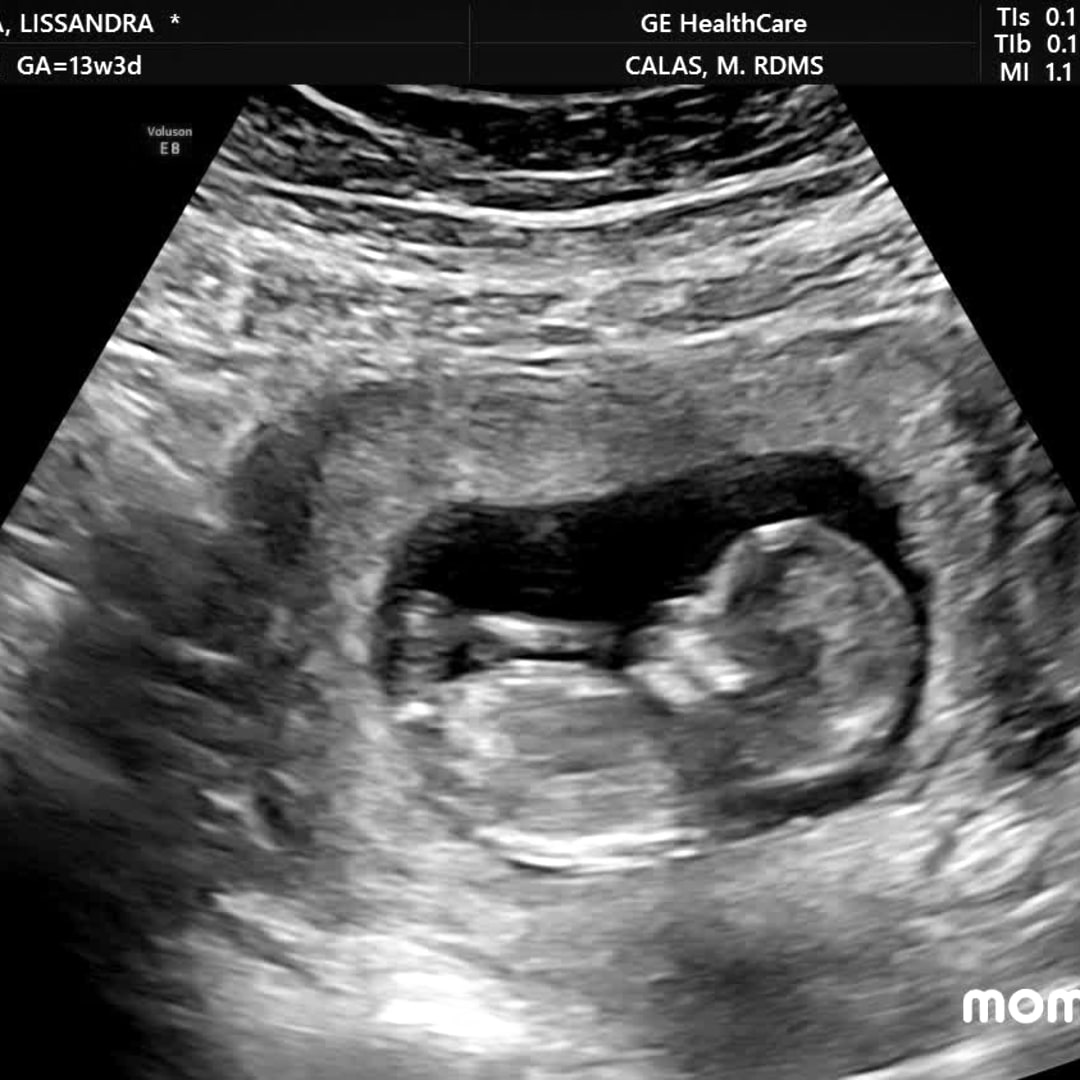 Photo shared by Lissandra for their Babylist baby registry.