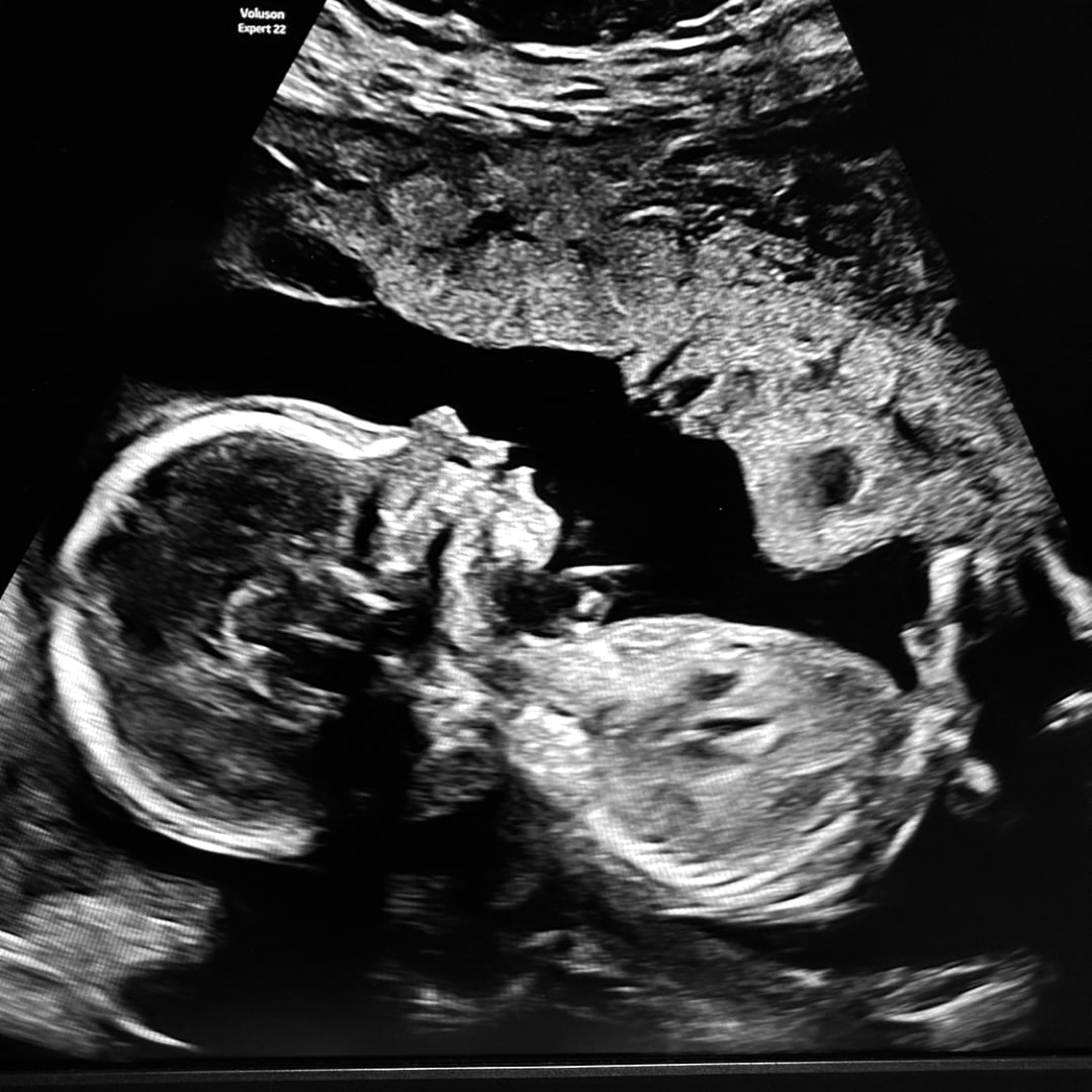 Photo shared by Inez for their Babylist baby registry.