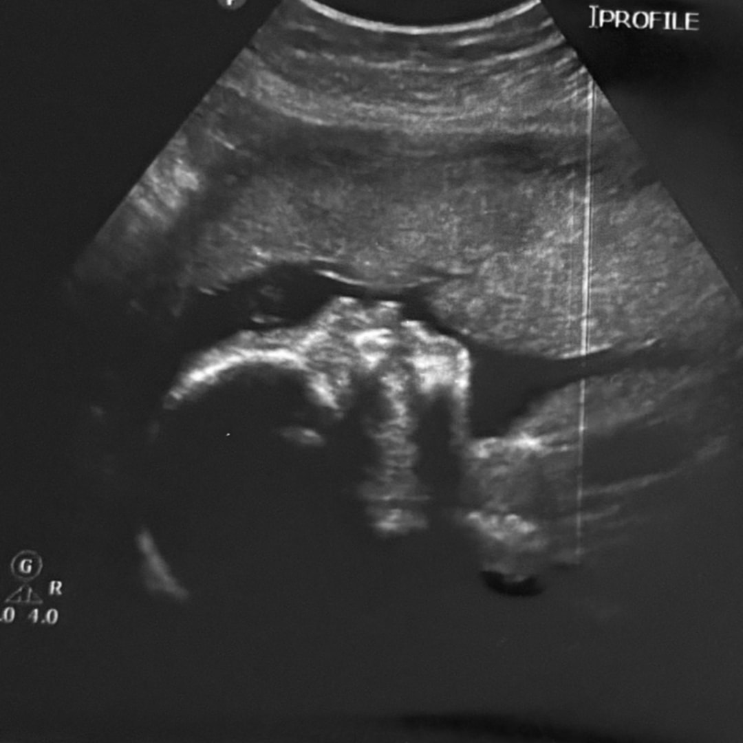 Photo shared by Brisa for their Babylist baby registry.