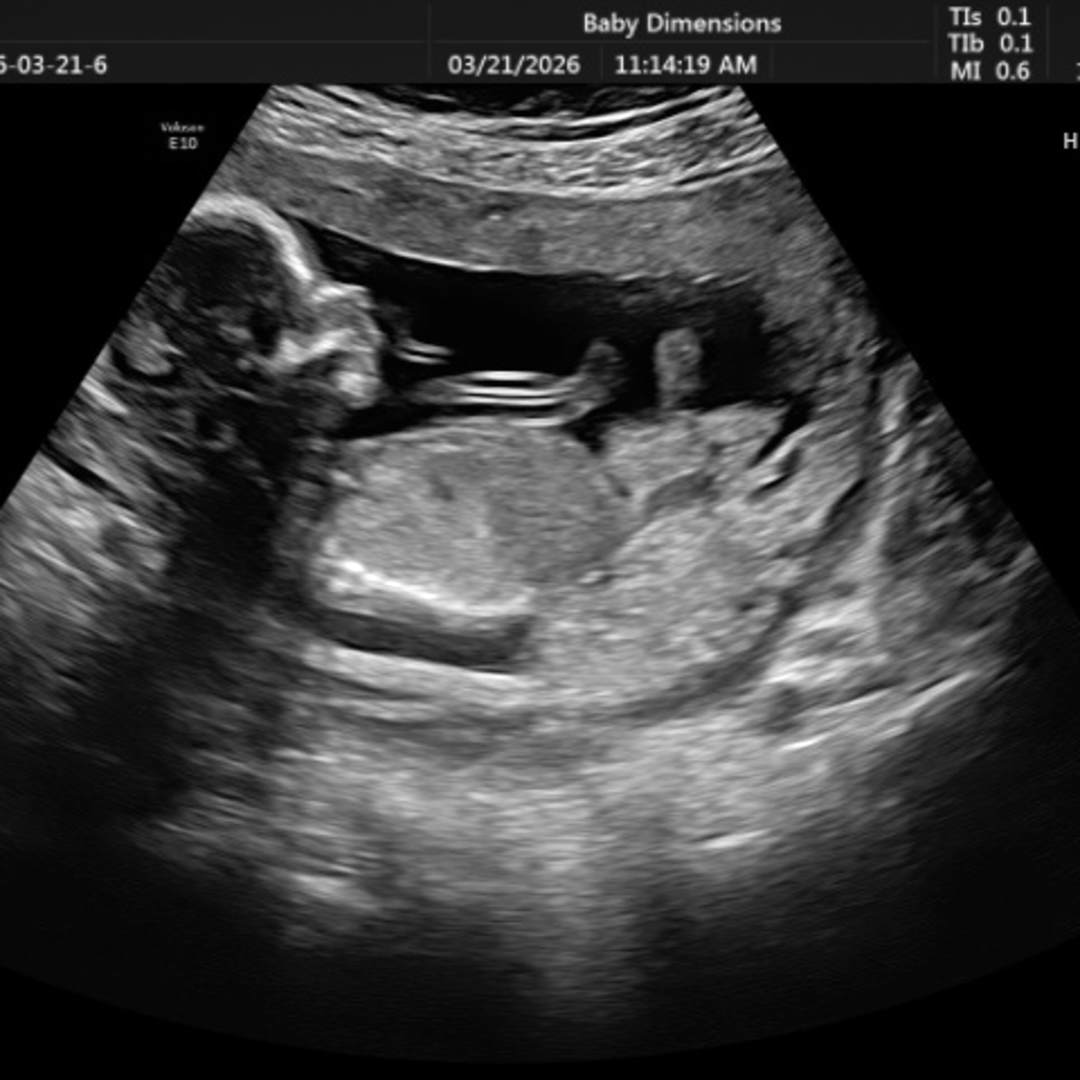 Photo shared by Ciera for their Babylist baby registry.