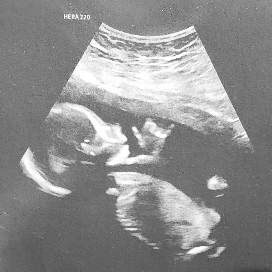 Photo shared by Elisa for their Babylist baby registry.