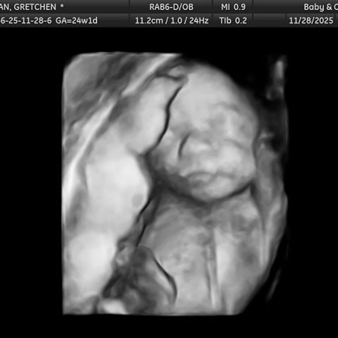 Photo shared by Gretchen for their Babylist baby registry.