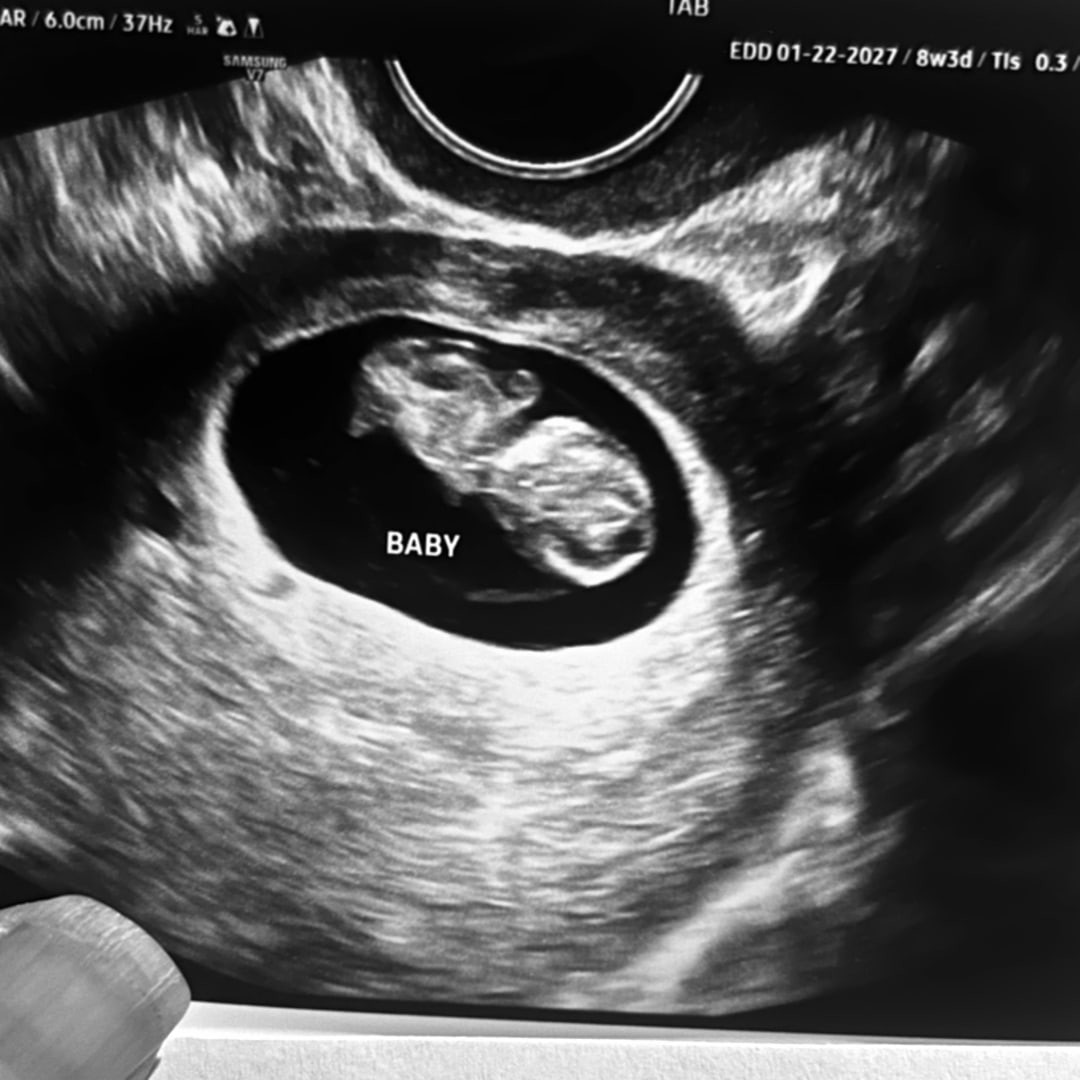 Photo shared by Lyndsey for their Babylist baby registry.