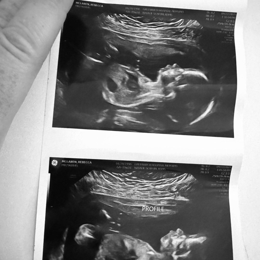 Photo shared by Rebecca for their Babylist baby registry.