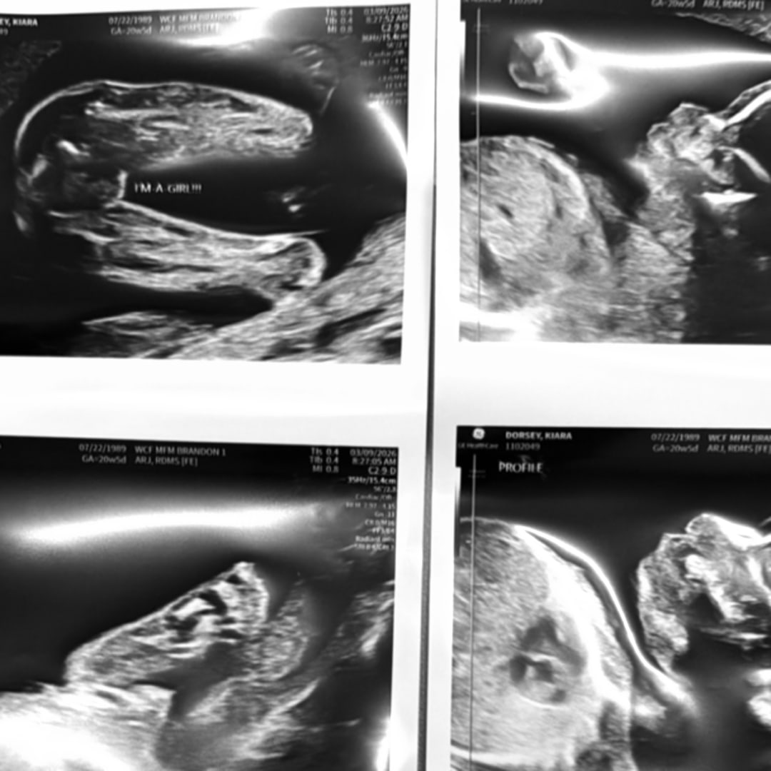 Photo shared by Kiara for their Babylist baby registry.