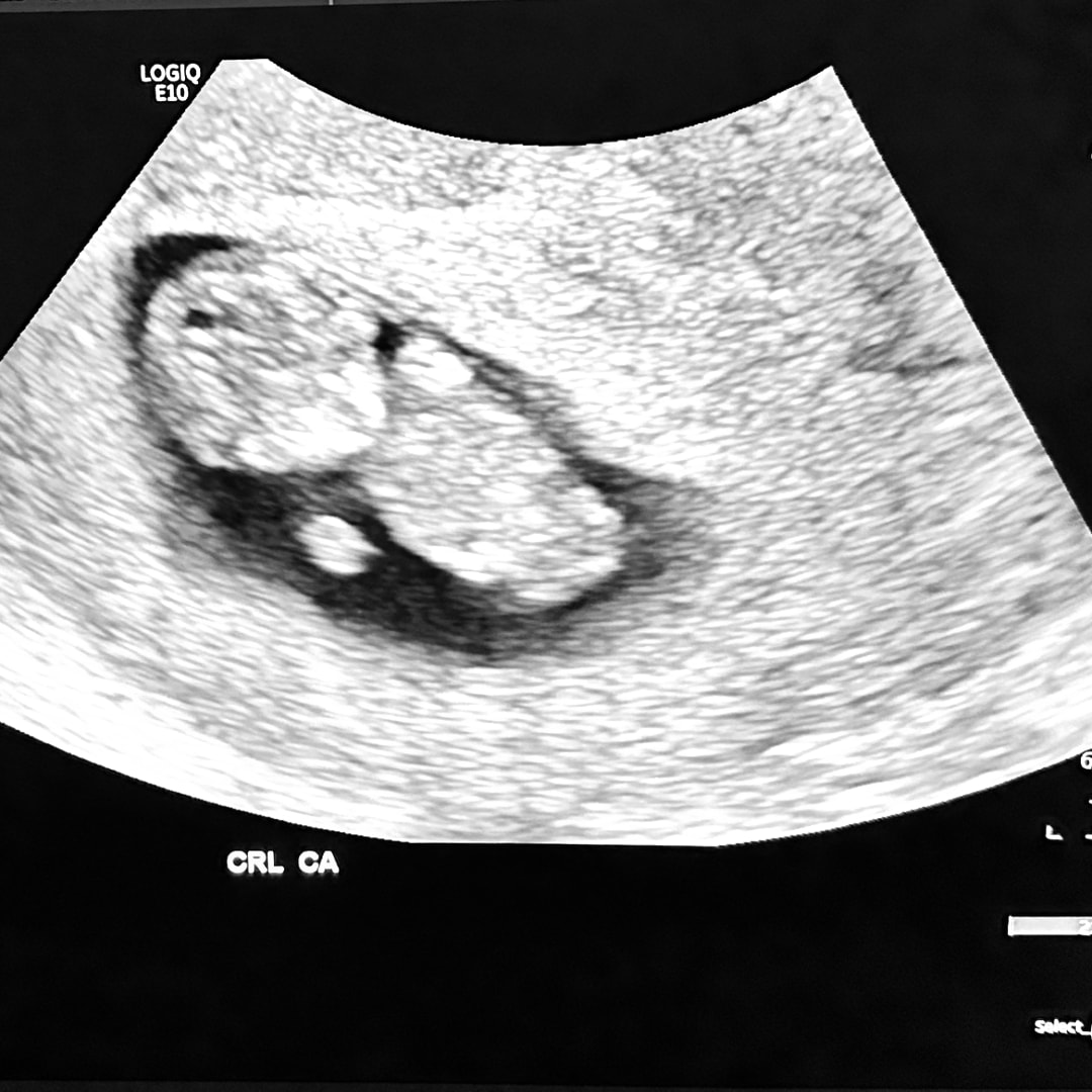 Photo shared by Aurora for their Babylist baby registry.