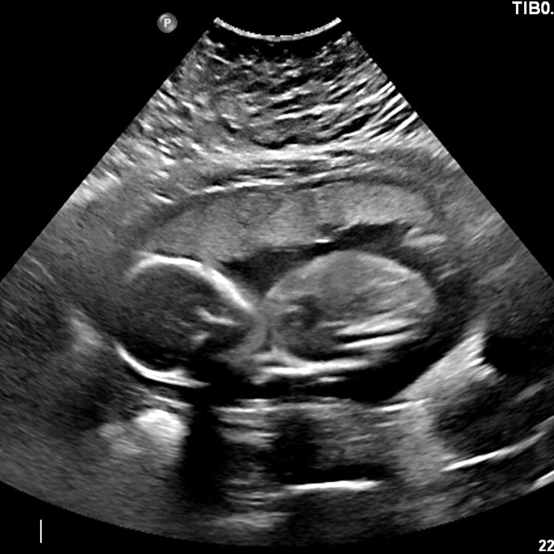 Photo shared by Maddy for their Babylist baby registry.