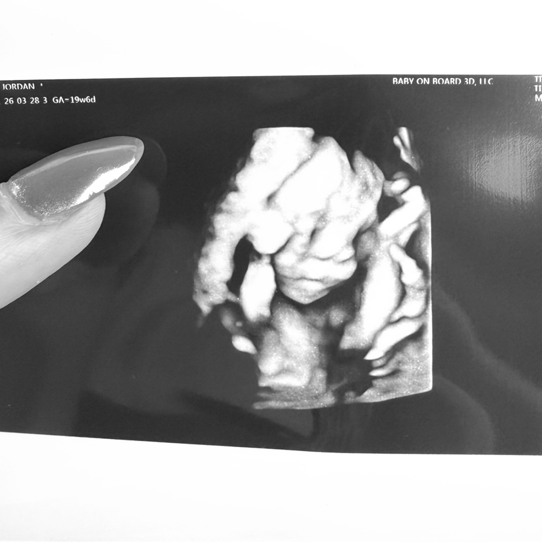 Photo shared by Jordan for their Babylist baby registry.