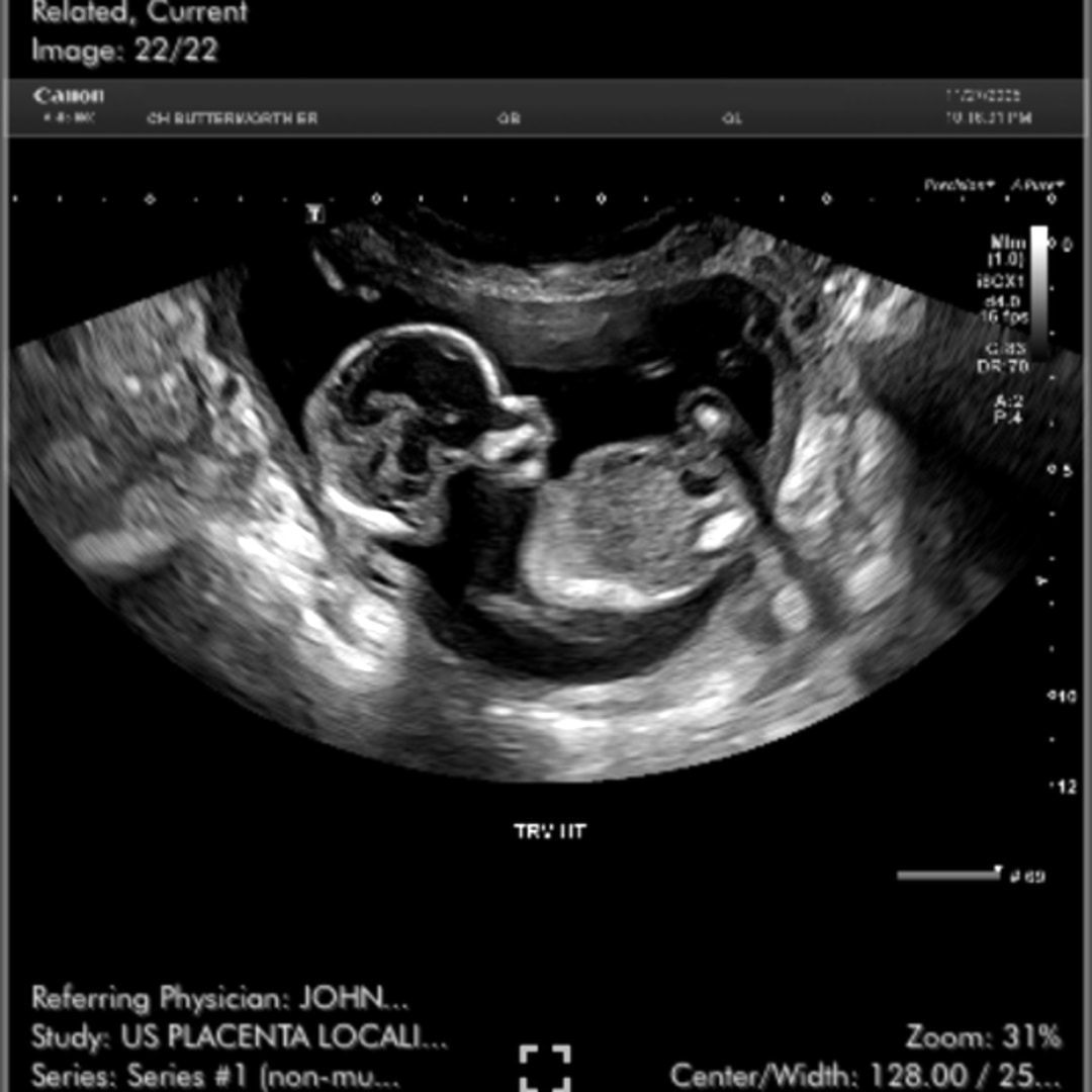 Photo shared by Ellie for their Babylist baby registry.