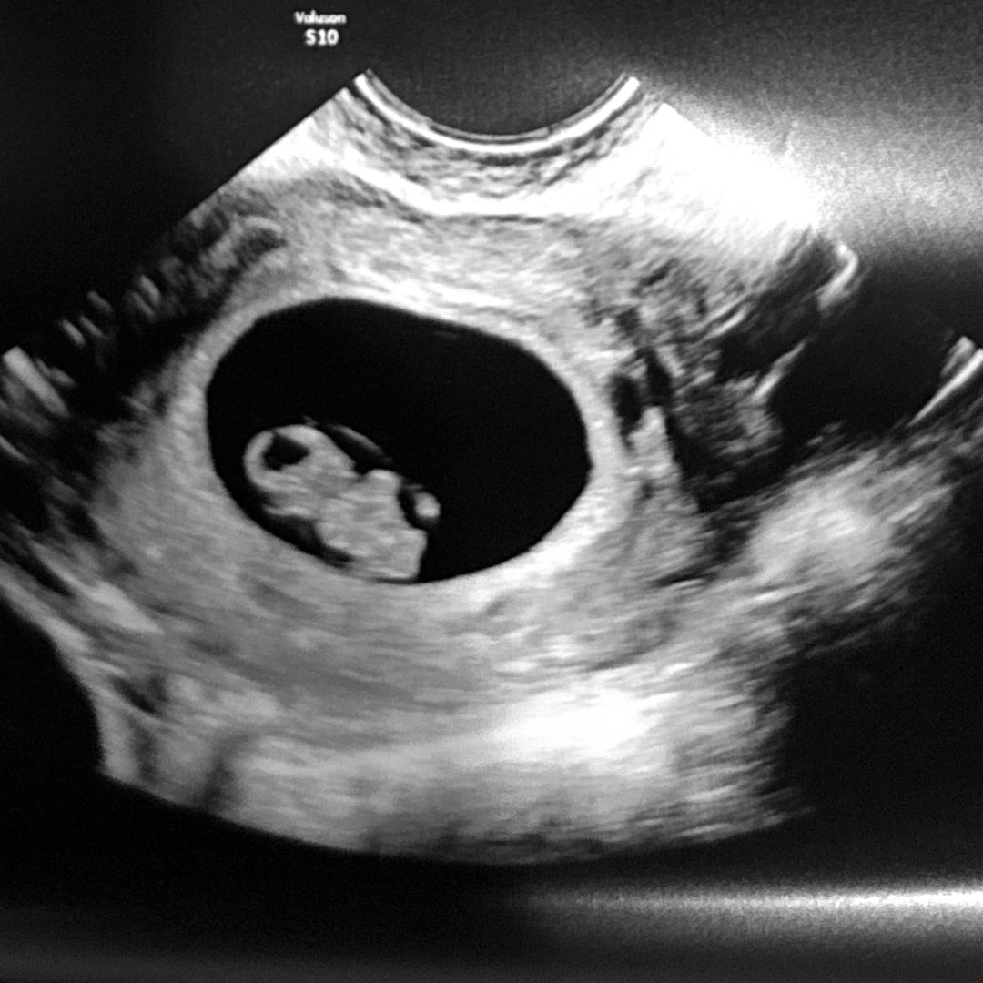 Photo shared by Yailin for their Babylist baby registry.