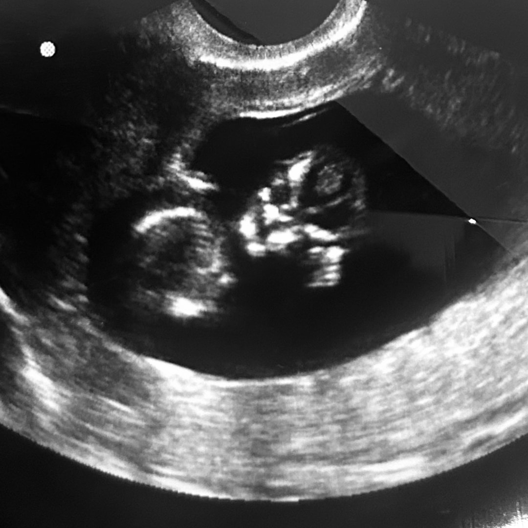 Photo shared by Angela for their Babylist baby registry.