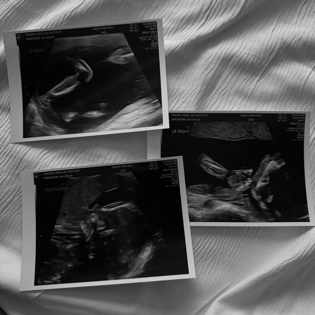 Photo shared by Nikki for their Babylist baby registry.