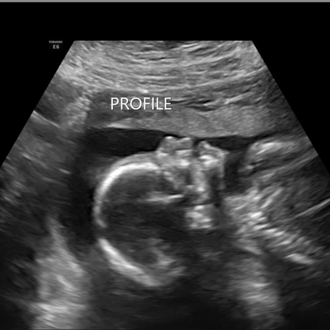 Photo shared by Tyler for their Babylist baby registry.