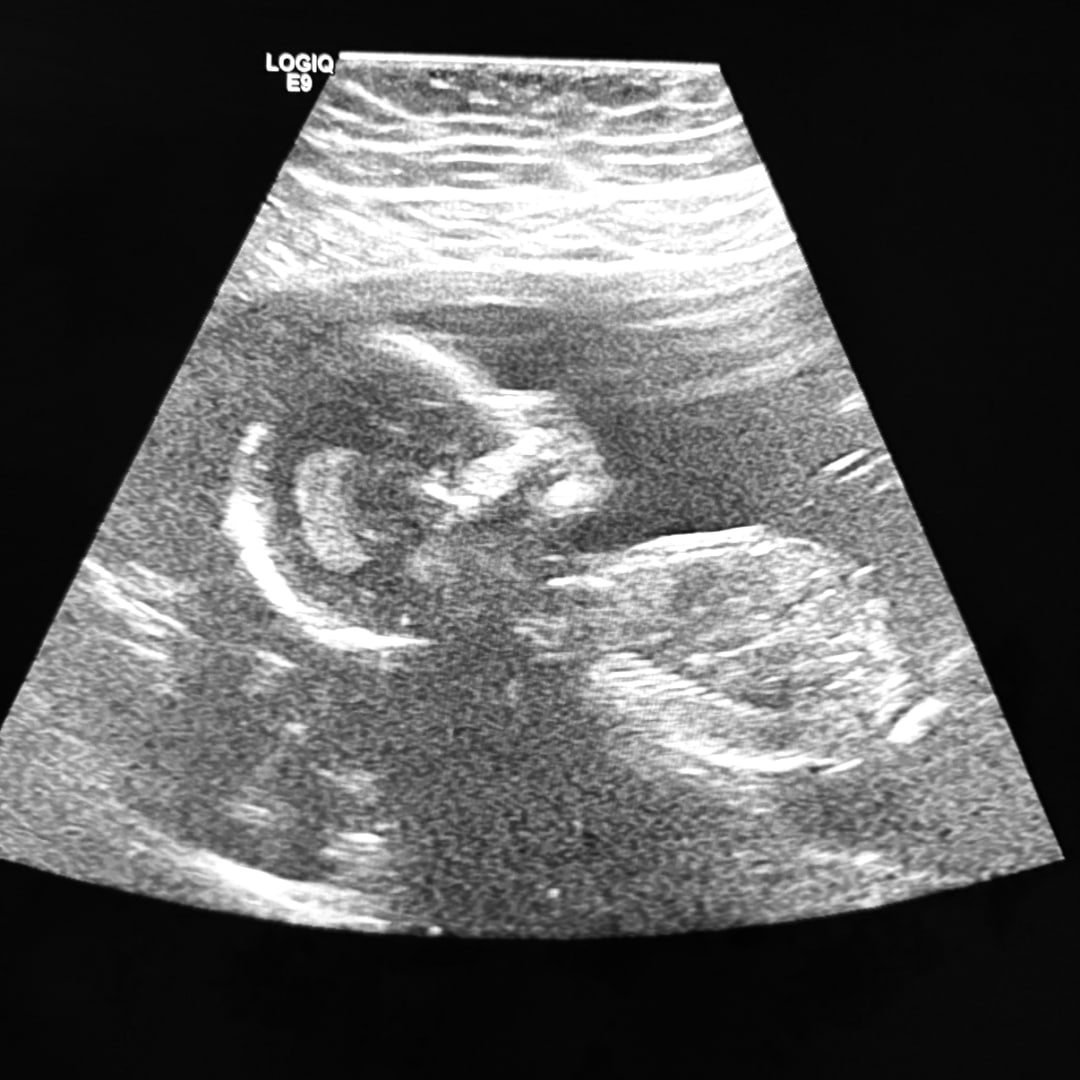 Photo shared by Rachel for their Babylist baby registry.