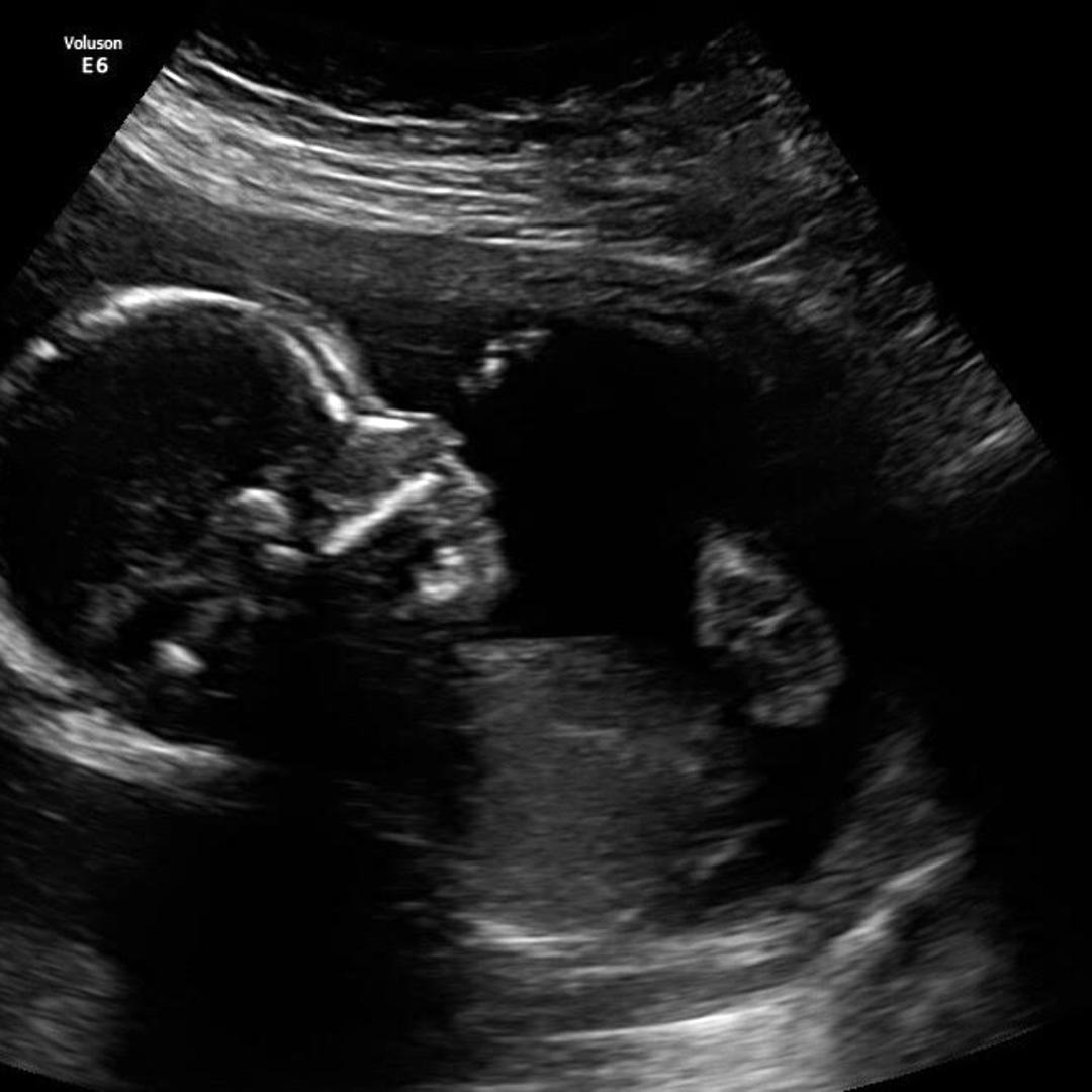 Photo shared by Jasreena for their Babylist baby registry.