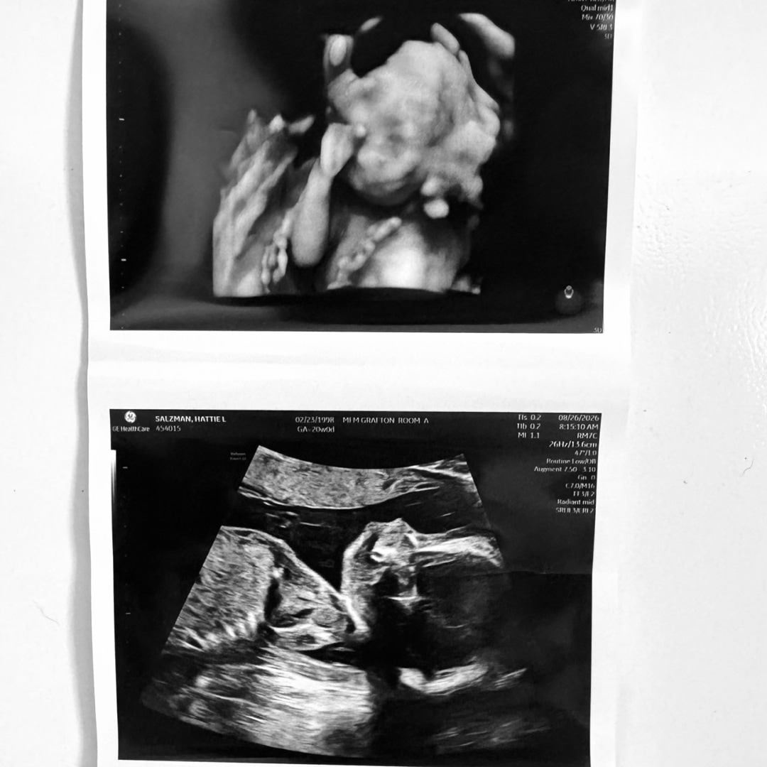 Photo shared by Hattie for their Babylist baby registry.