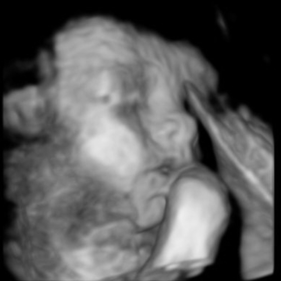 Photo shared by Alexandra for their Babylist baby registry.