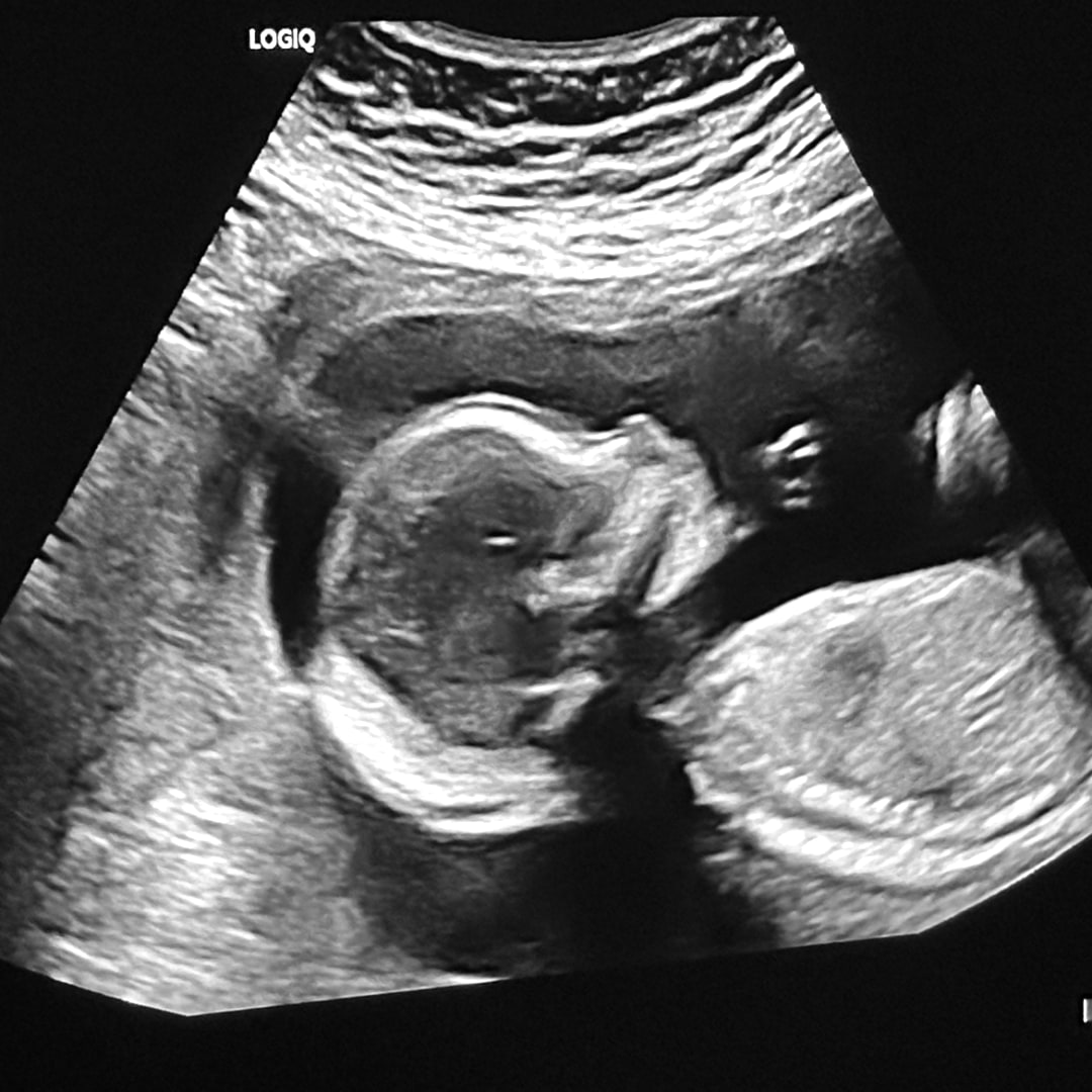 Photo shared by Bianca for their Babylist baby registry.
