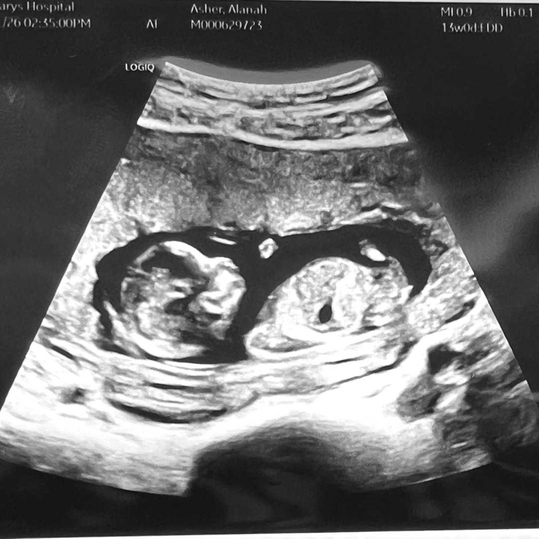 Photo shared by Alanah for their Babylist baby registry.