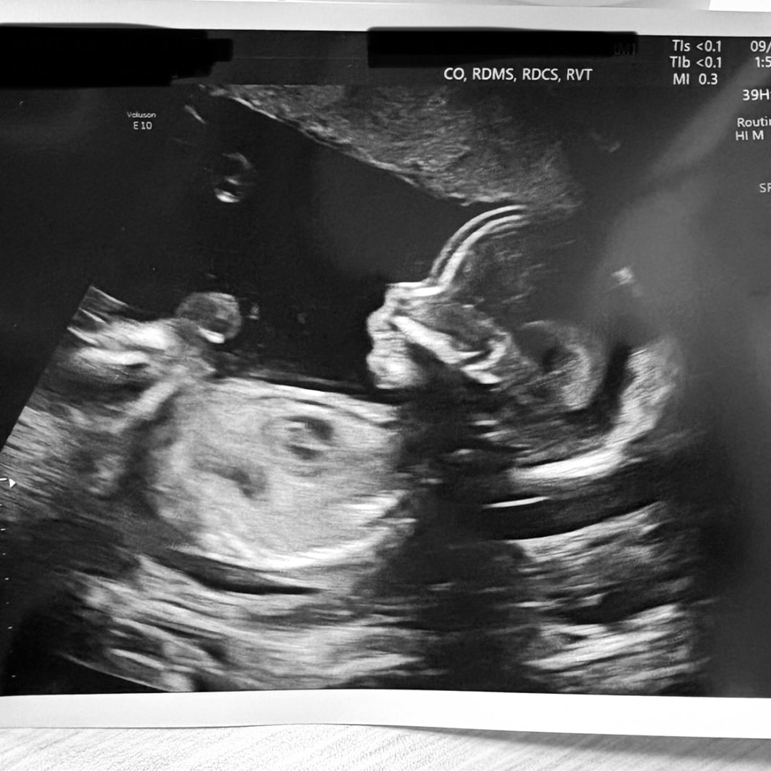 Photo shared by Kelli for their Babylist baby registry.