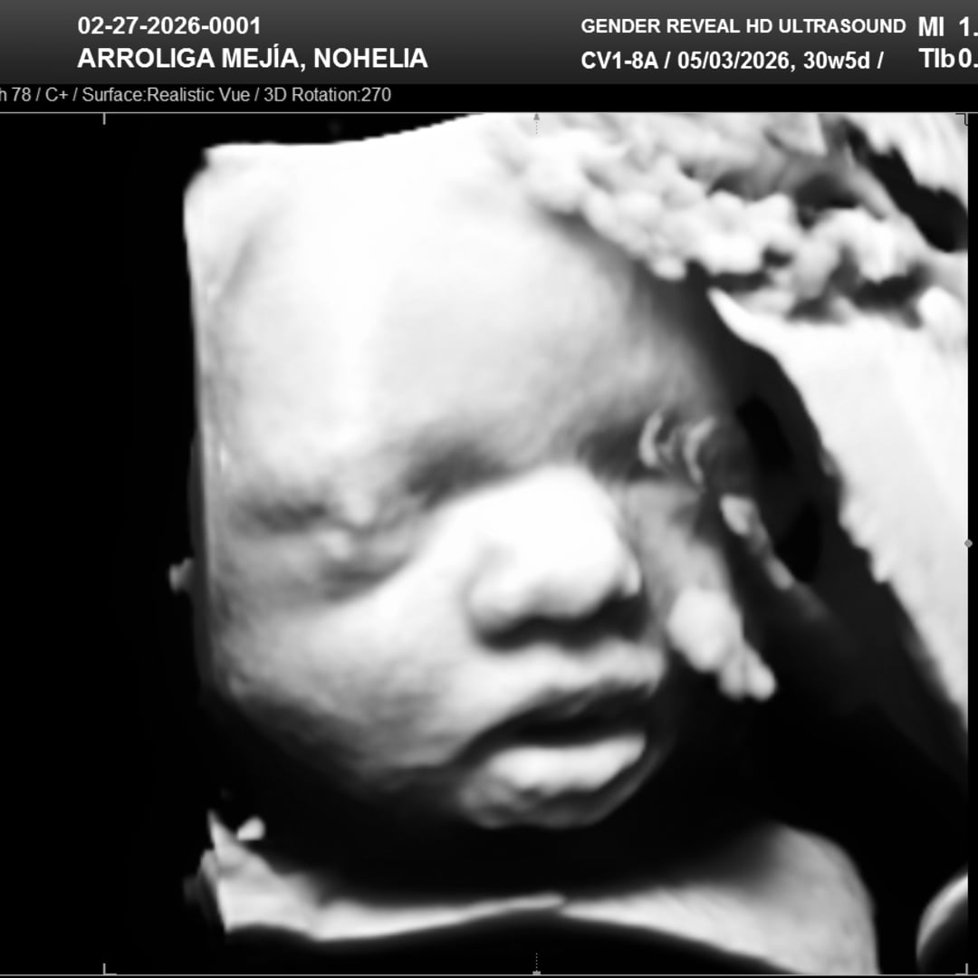 Photo shared by Nohelia for their Babylist baby registry.