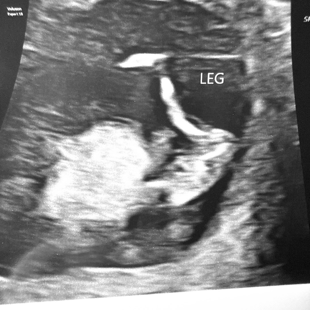 Photo shared by Karen for their Babylist baby registry.
