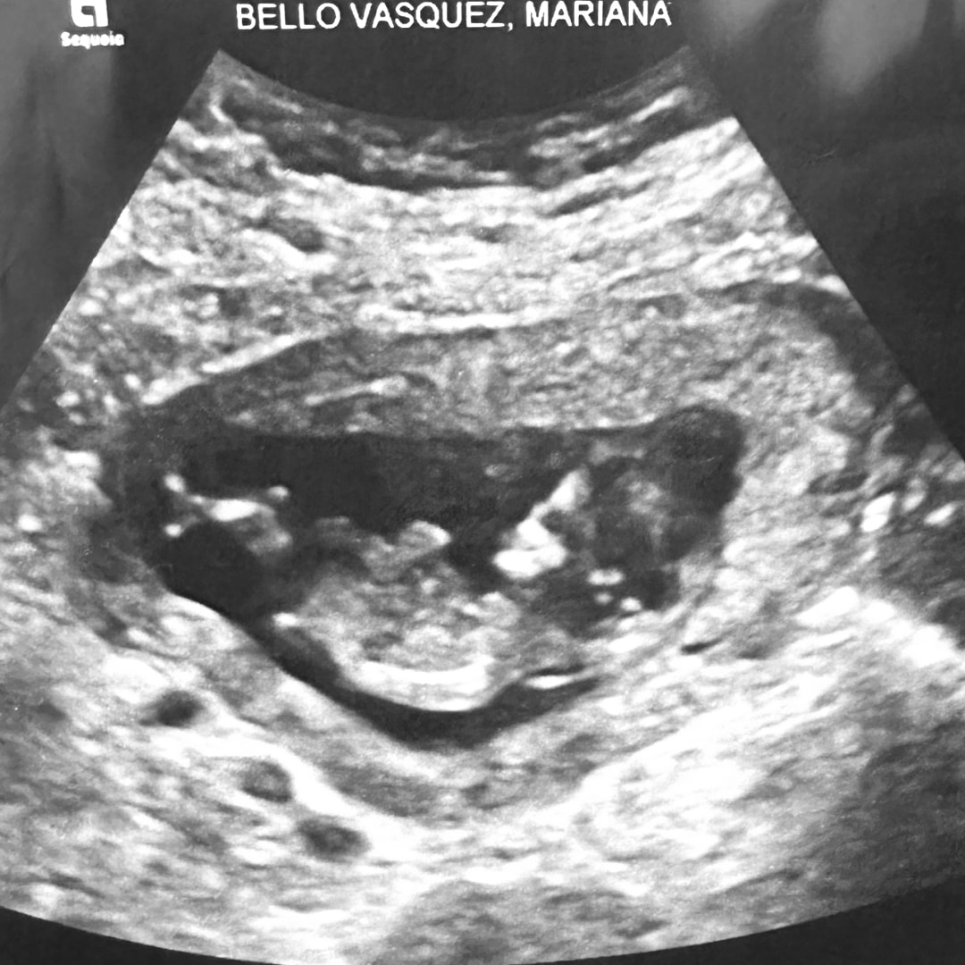 Photo shared by Mariana for their Babylist baby registry.