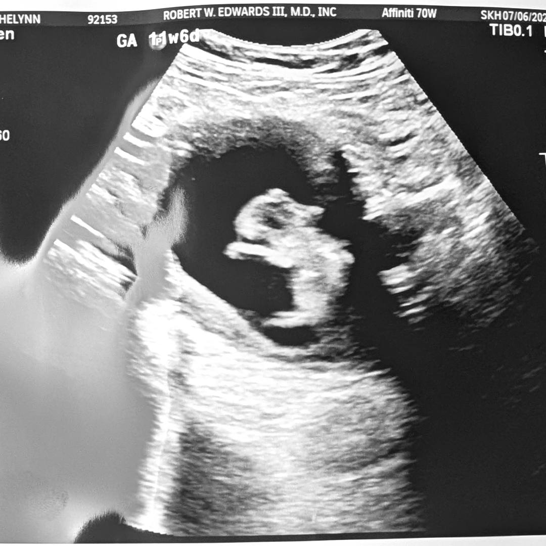 Photo shared by Ashelynn for their Babylist baby registry.