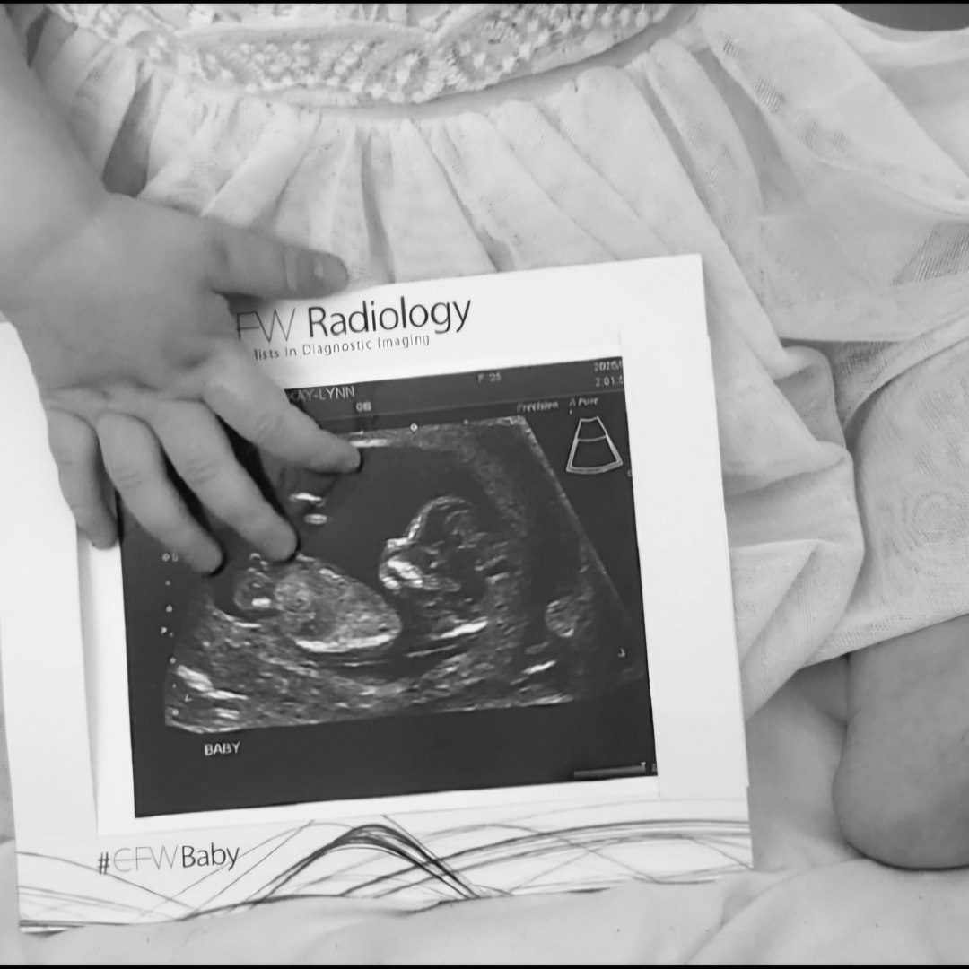 Photo shared by Kay-lynn for their Babylist baby registry.