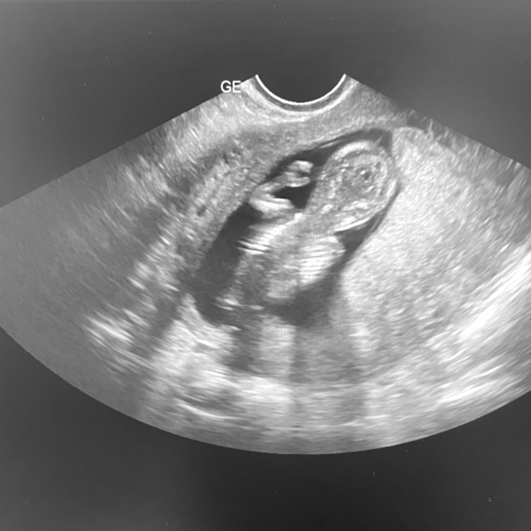 Photo shared by Catherine for their Babylist baby registry.