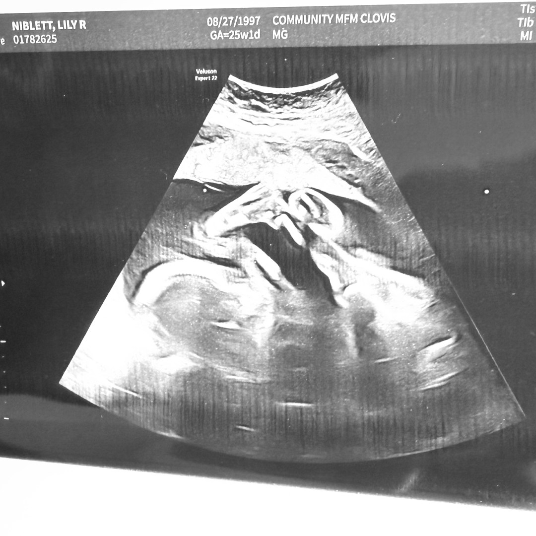 Photo shared by Lily for their Babylist baby registry.