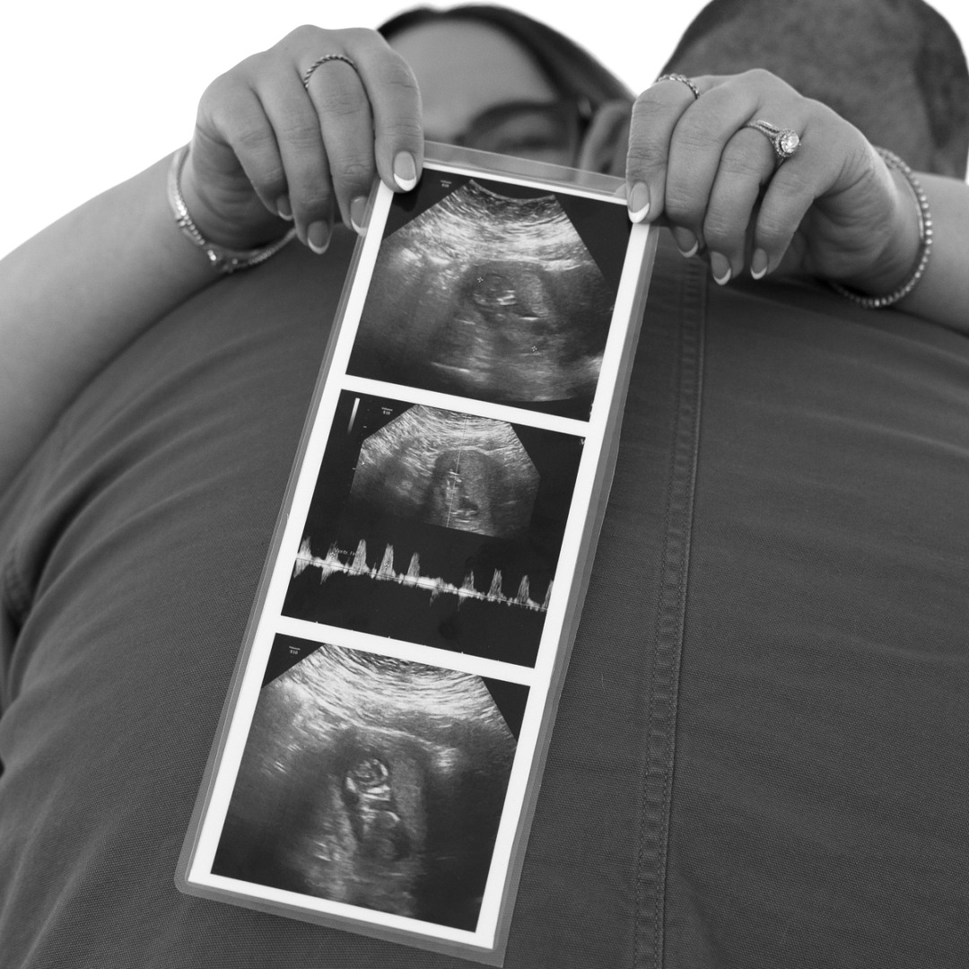 Photo shared by Alison for their Babylist baby registry.