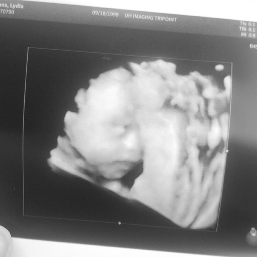 Photo shared by Lydia for their Babylist baby registry.