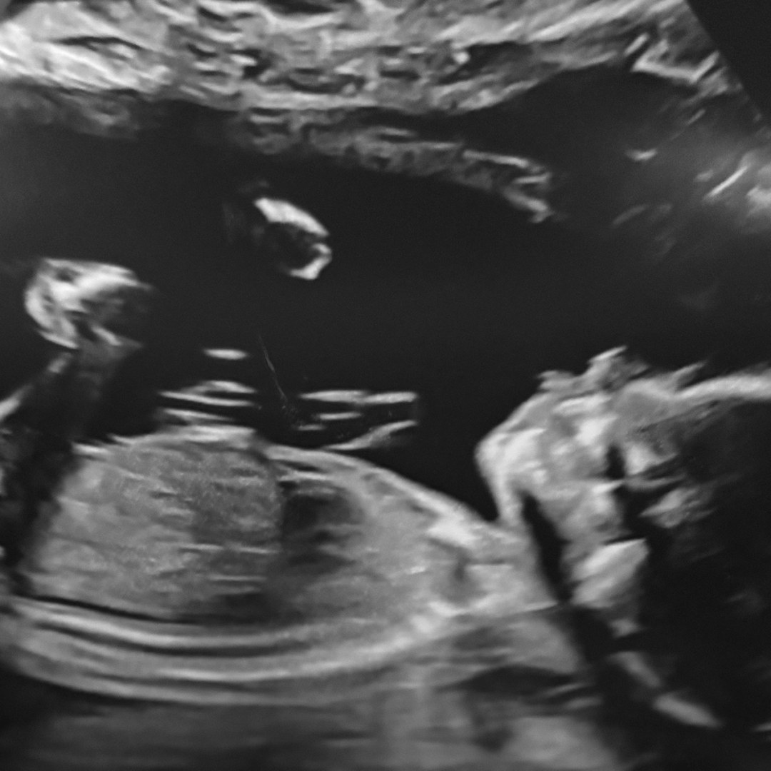 Photo shared by Courtney for their Babylist baby registry.