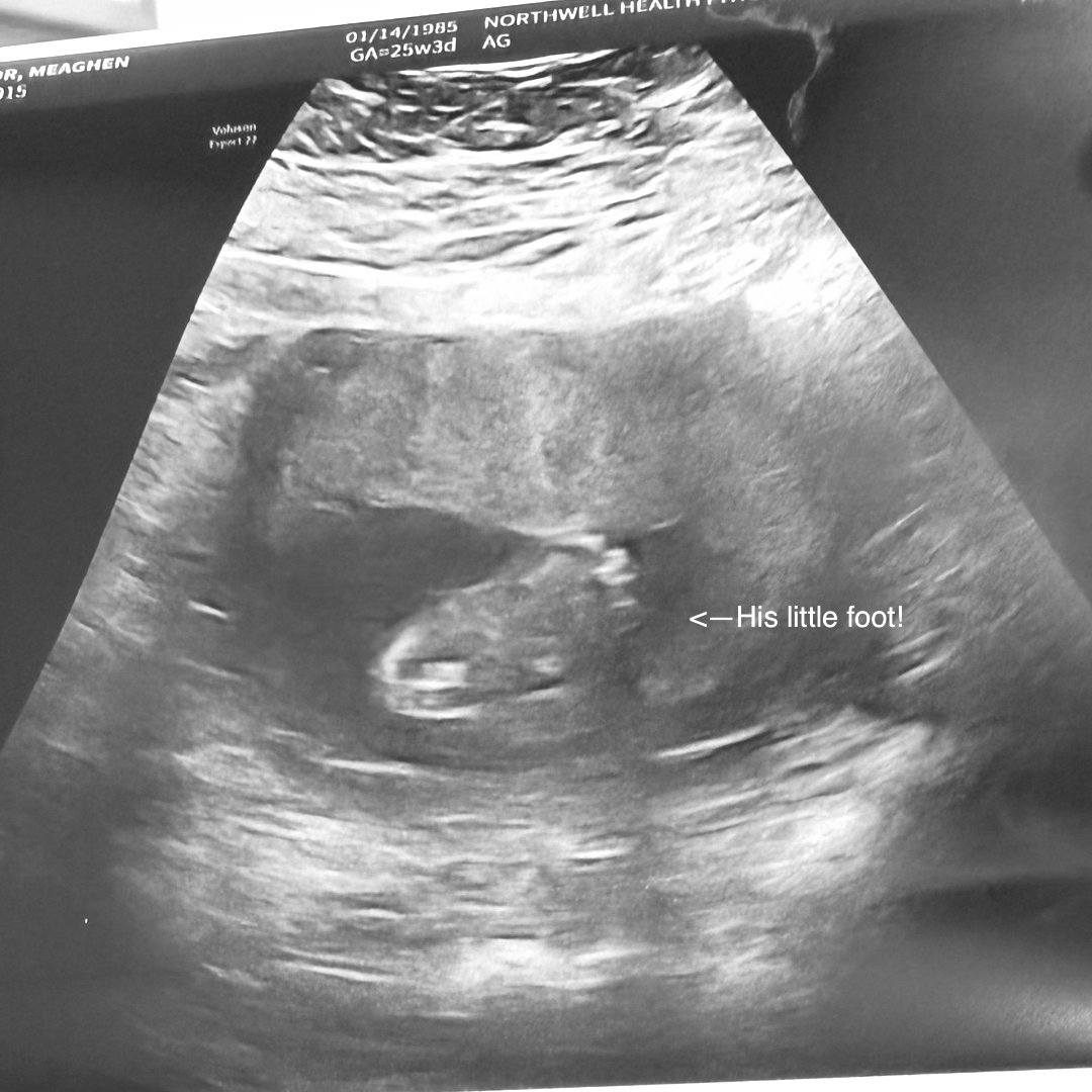 Photo shared by Meaghen for their Babylist baby registry.