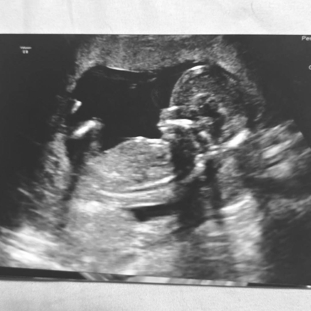Photo shared by Natalie for their Babylist baby registry.
